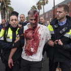 Uno de los heridos en la Escola Mediterrànea de la Barceloneta durante las cartas policiales el 1-O.