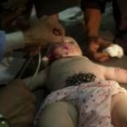 Los médicos intentan salvar la vida de un bebé iraquí herido