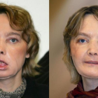 Isabelle Dinoire, en su primera aparición pública tras someterse al trasplante, en febrero del 2006 (izquierda), y nueve meses después.