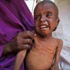 Un niño somalí de 7 años que padece malnutrición en el campo de desplazados de Garasbaley, a las afueras de Mogadiscio, la capital de  Somalia.