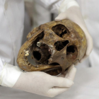 El cráneo de Josep Mengele, en la Universidad de Medicina de Sao Paulo.
