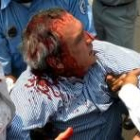 El hijo del presidente fue alcanzado por una piedra en la cabeza