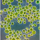 Chlorella, un alga unicelular común en el suelo.  Andrei Savitskymageno
