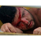 Un hincha del Paranaense, herido en la pelea entre aficiones.