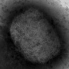 Virus de la viruela del mono por microscopía electrónica, facilitada por el Instituto de Salud Carlos III. DL