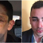 Imagen de los agredidos, que muestran las heridas del ataque sufrido en Berga.
