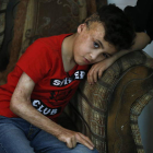 Imagen de un niño herido tras un ataque de colonos. ALAA BADARNEH