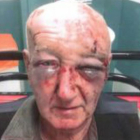 La policía de Manchester ha publicado esta imagen de las lesiones del señor Laidlaw.