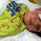 El pequeño, tras las primeras curas en el párpado y la barbilla practicadas en el Hospital de León.