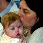 La niña, Alessia Di Mateo, se recupera favorablemente de una operación multivisceral