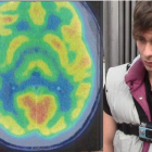 Imágenes de las pruebas neurológicas practicadas al asesino Patrick Nogueira.