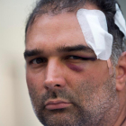 José Bravo, el turista estadounidense de origen cubano que fue agredido el miércoles por un grupo de manteros