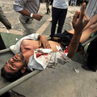 Un opositor yemení es trasladado a un hospital tras resultar herido en un enfrentamiento.