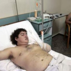 Franns Rilles Melgar, el hombre que sufrió la amputación del brazo izquierdo .