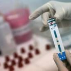 Un médico sostiene en sus manos una prueba de VIH, enfermedad que afecta a más de 120.000 jóvenes