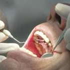 Cuando se hace necesaria la ortodoncia también es preciso realizar una higiene dental más minuciosa