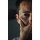 El hombre agredido, con lesiones en su rostro.