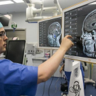 Imagen proyectada de un paciente en el nuevo navegador del Servicio de Neurocirugía de Vall d'Hebron. Se acopla al ecógrafo digital.
