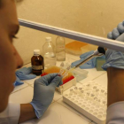 Imagen de los análisis de la sanfre infectada por zika. MARCELO SAYAO