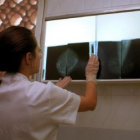 Estudio de una mamografía dentro de un programa de prevención del cáncer de mama