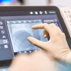 La implantación directa del tejido en el cuerpo evita problemas de rechazos e infecciones. r.p.