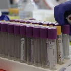 Tubos para guardar la sangre de las donaciones.
