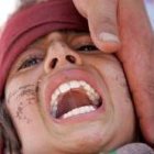 Una niña grita de dolor mientras espera atención médica
