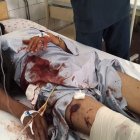 Uno de los heridos en el atentado suicida recibe asistencia en el hospital.