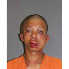 El rostro de Raymond Frolander tras ser golpeado por el padre de la vícimta.