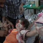 Dos niñas sirias son atendidas en un hospital de la localidad rebelde de Douma tras sufrir un ataque aéreo del régimen de Damasco.