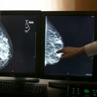 Imagen de archivo de una mamografía en 3D, que permite mejorar la detección del cáncer de mama.