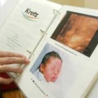 Imagen de un recién nacido y de su foto obtenida con ecográfo