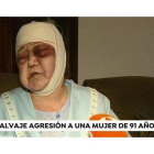 La mujer agredida, durante su intervención en Espejo público, de Antena 3.