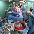Una operación de trasplante de hígado en un hospital.