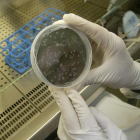Muestra de tuberculosis en el laboratorio.