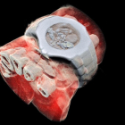 Imagen de la radiografía en 3D de una muñeca.