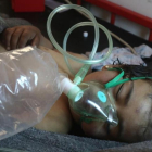 Un niño sirio recibe tratamiento tras el ataque con gass tóxico.