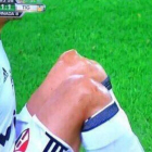 Óscar Ustari, tras lesionarse