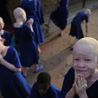 Centro donde se aloja y protege a niños albinos en Tanzania.