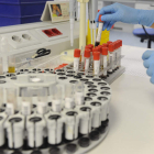 Las pruebas de consejo genético incluyen un test sanguíneo.