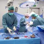 Intervención para realizar un trasplante de órganos. EFE