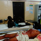 Una víctima de un ataque suicida yace en una cama de hospital esperando a ser atendida, en Maiduguri (nordeste de Nigeria), el 15 de agosto
