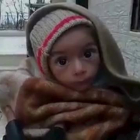 Un bebé desnutrido en Madaya.