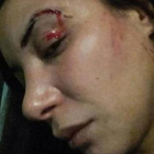 Imagen de la agresión a la actriz Lubna Avidar.