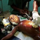 En la foto de archivo se ve un niño angolés siendo atendido por Médicos sin Fronteras en este país