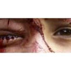 Mirada de una niña iraquí herida tras un bombardeo de la coalición