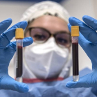 Una sanitaria sosteniendo dos muestras de sangre. LUCA ZENNARO / EFE