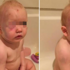 El pequeño Jacob, con la cabeza llena de hematomas y heridas, en la fotodenuncia que han hecho sus padres en Facebook.