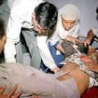 Uno de los peregrinos hindúes heridos cuando era trasladado al hospital de Srinagar