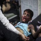 Un niño recibe atención médica tras un ataque de las fuerzas del régimen sirio en Duma.